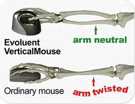 Evoluent VerticalMouse 3, hyre hnd